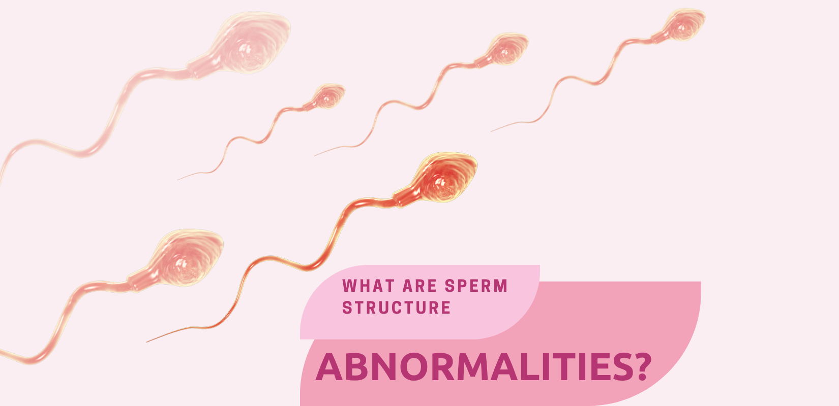 What are Sperm Structure Abnormalities?