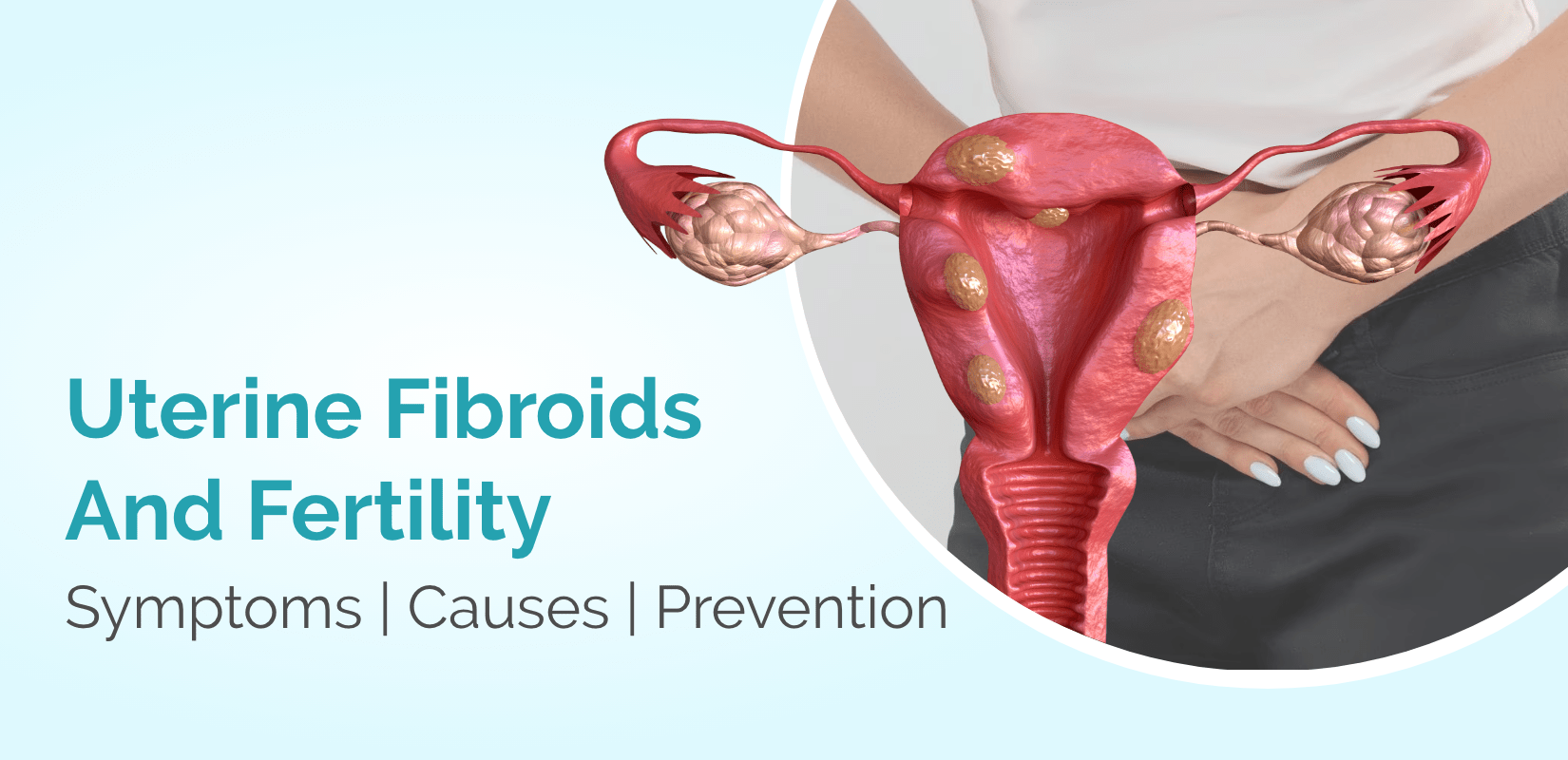 Uterine Fibroids And Fertility: Symptoms, Causes, Prevention